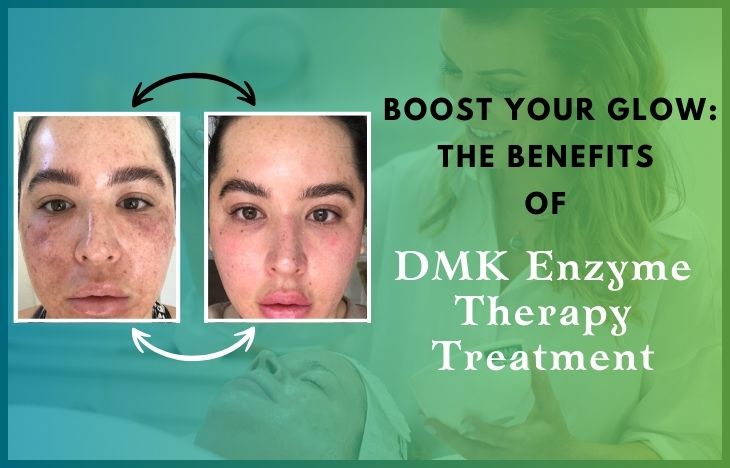 Boost-Your-Glow-The-Benefits-of-DMK-Enzyme-Therapy-Treatment