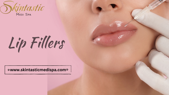 lip filler in Riverside