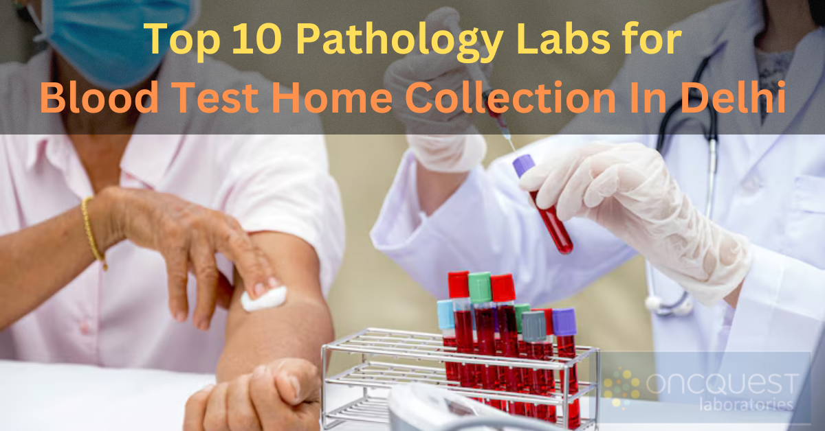 Top 10 Best Pathology Labs for Blood Test Home Collection In Delhi