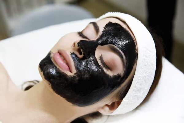 Carbon Facials