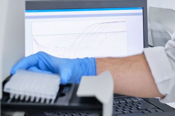 Multiplex qPCR Analysis