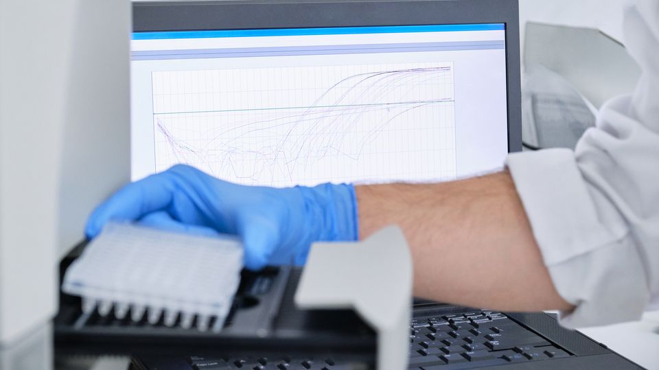 Multiplex qPCR Analysis